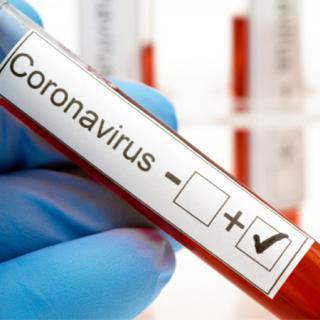 Aktuálne informácie o koronavíruse